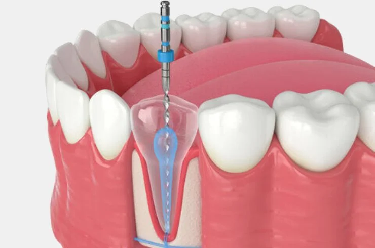 Endodontics